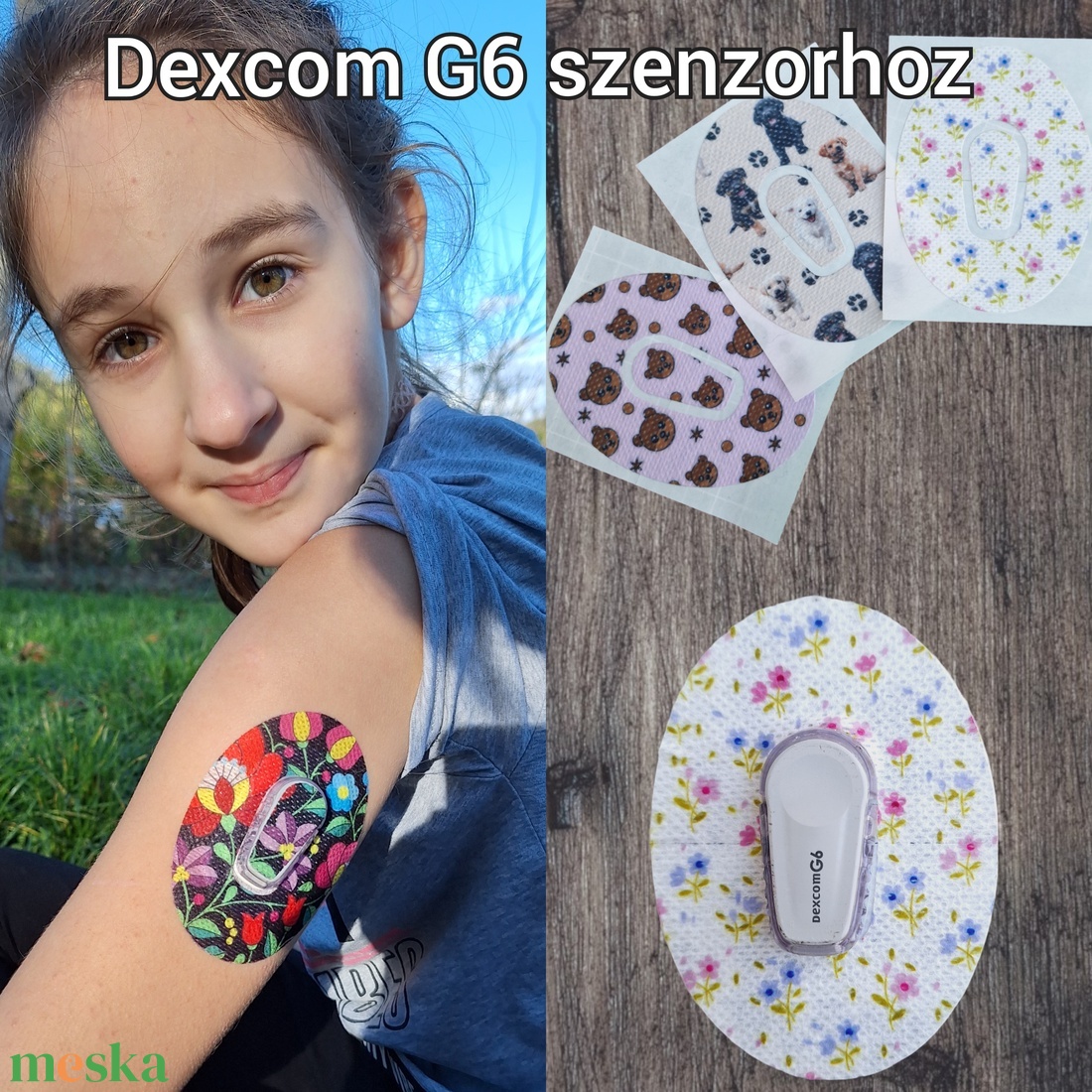 Dexcom G6 vércukormérő szenzorhoz mintás tapasz (szenzortapasz) 5 db/ csomag - otthon & életmód - papír írószer - matrica, matrica csomag - Meska.hu